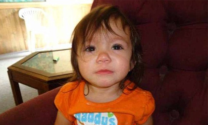 Mẹ 18 tuổi lơ là, để con gái nhỏ bị chó cắn chết