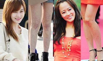 "Giật mình" vì những đôi chân đầy "tì vết" của mỹ nhân Hàn