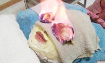 Những liệu pháp làm đẹp cực 'độc'