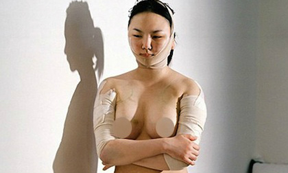 Kinh hãi hình ảnh thiếu nữ Hàn chịu đau đớn vì thẩm mỹ