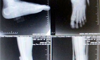 Móc túi bệnh nhân hàng tỉ đồng bằng cắt xén, tráo phim