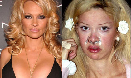 Sao US - UK hối hận vì đã phẫu thuật thẩm mỹ