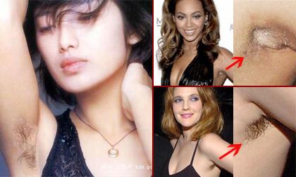 Phát hoảng vì 'vùng cánh' chi chít 'vi-ô-lông' của sao