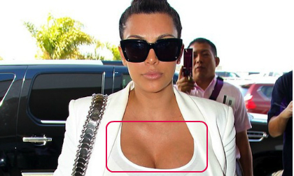 Bà bầu Kim nổi gân chằng chịt vùng ngực