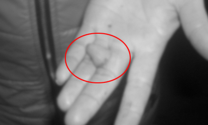 Giở trò đồi bại, "yêu râu xanh" bị... cắn đứt lưỡi