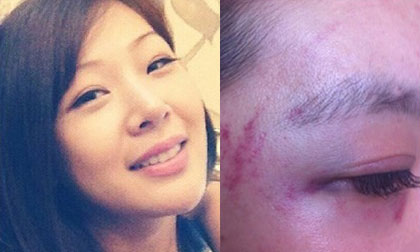 Sao nữ Hàn bị buộc tội hành hung phụ nữ