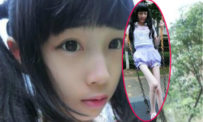 Xôn xao cô bé đáng yêu gầy như bộ xương