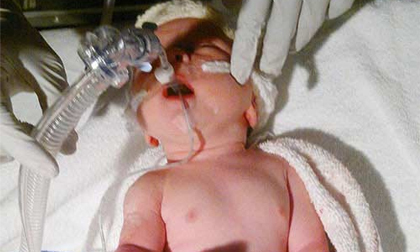 Bé trai 2 tuổi có tử cung