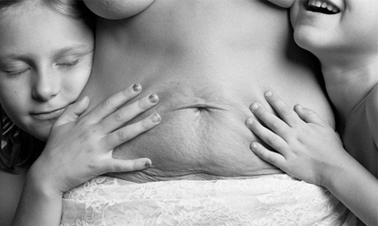 Hình ảnh chân thực về cơ thể của người phụ nữ sau khi sinh