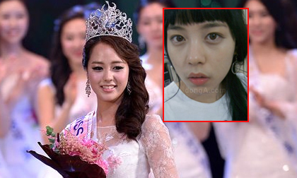 Tân hoa hậu Hàn lại bị mổ xẻ nhan sắc