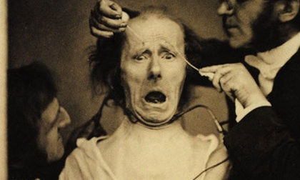 Những thí nghiệm kinh hoàng trên cơ thể con người