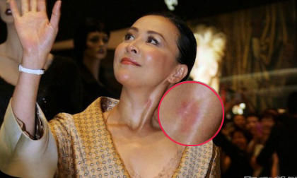 Lưu Gia Linh như mặc váy ngủ lộ vết "yêu đương"