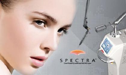 Spectra Laser Toning – bước đột phá trong công nghệ điều trị nám da