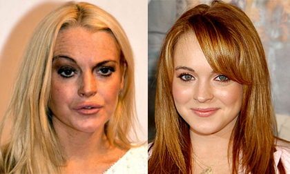 Sao 'biến dạng' nhan sắc vì ma túy