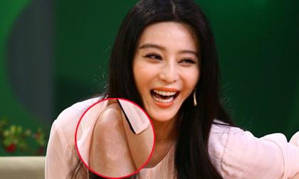 Phạm Băng Băng lộ "dấu vết" khó hiểu trên đầu gối