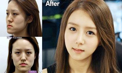 Cô gái xấu xí được phẫu thuật thành 'bản sao YoonA (SNSD)'