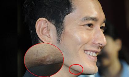 Huỳnh Hiểu Minh lộ mụn sẹo sần sùi dưới cằm