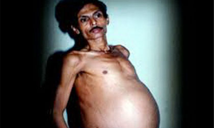 Những người đàn ông "dị" nhất thế giới