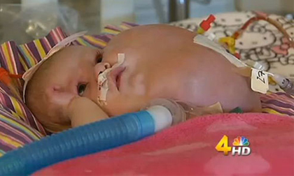 Bé gái có khuôn mặt dưa gang