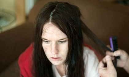 Bộ ảnh về một cô gái trẻ nghiện heroin khát khao tìm lại cuộc sống