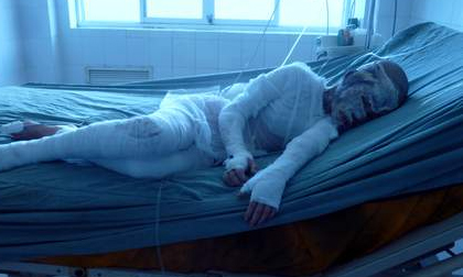 Vụ tạt axít 5 người: Kẻ "cuồng yêu" tạt axit gia đình chủ khai gì?