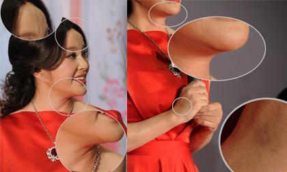 Lưu Hiểu Khánh lộ nếp nhăn và vết bầm khó hiểu trên tay