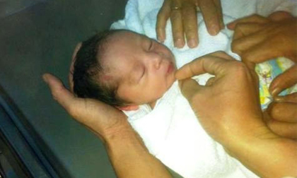 Sản phụ chết bất thường: Lại do 'thuyên tắc ối'