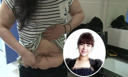 Từ "mẹ sề" biến thành "gái đẹp" nhờ phẫu thuật thẩm mỹ