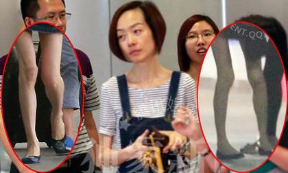 Sốc với chân tay cong queo của MC gầy nhất Trung Quốc