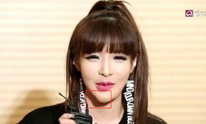 Park Bom lộ cằm méo mó 