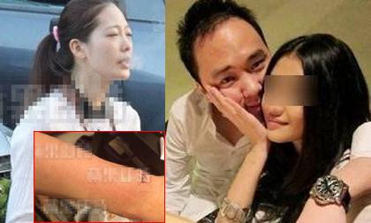 Sao nữ bị thiếu gia Lý Tông Thụy cưỡng hiếp lộ vết từng cắt cổ tay tự tử