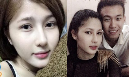 “Sốc” với tin Trâm Anh 9 lần phẫu thuật vì tình yêu