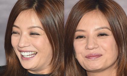 Giật mình với gương mặt rúm ró và kém sắc của Triệu Vy