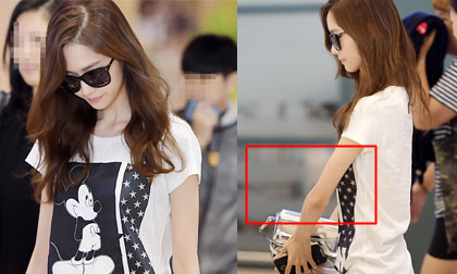 Hết bị chê chân vòng kiềng, Yoona lại bị 'soi' tay gầy nhẳng