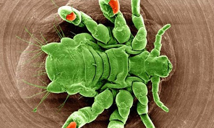 Nhận diện và phòng rận mu tấn công bộ phận sinh dục