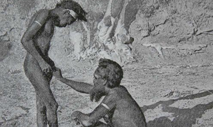 Hãi hùng tục... ăn bao quy đầu của mình để trưởng thành