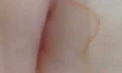 Giun sán bò lổm ngổm trên miếng thịt lợn mua trong siêu thị