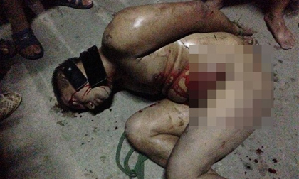 Trộm bị lột sạch đồ, trói và đánh hội đồng dã man