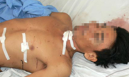 Dùng kéo giết bạn gái dã man rồi tự sát