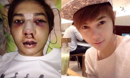 Thêm một chàng trai Thái Lan khoe ảnh 'thay da đổi thịt' gây sốt