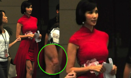 Lâm Chí Linh lộ chân xấu xí và mặt cứng đờ như thẩm mỹ