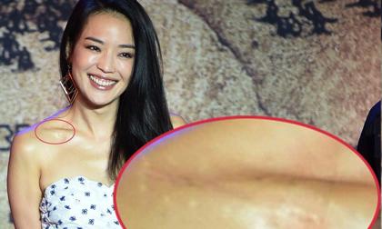 Thư Kỳ lộ vết sẹo lớn trên xương đòn