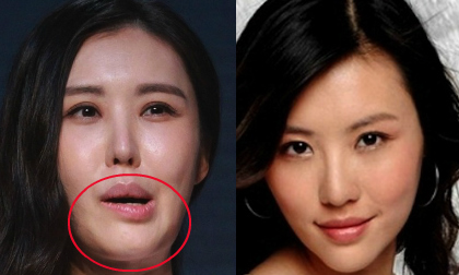 Sao 'Chân hoàn truyện' bị nghi thẩm mỹ hỏng với mặt biến dạng