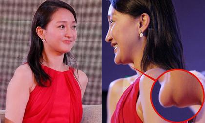 Châu Tấn lộ cằm lồi lõm dị dạng