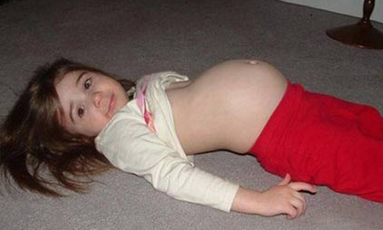 Sốc: Cô bé “mang thai” 3 con rắn suốt 5 năm