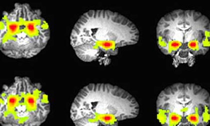 Hé lộ bí mật của bộ não thanh thiếu niên hư