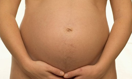 Chuyện khó tin: Người phụ nữ đẻ ra... hòn đá lớn