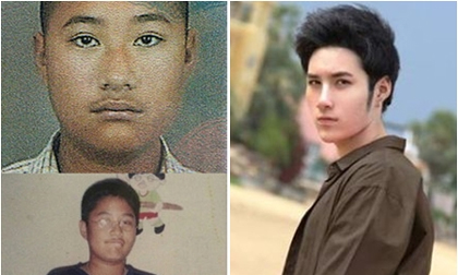 Chàng trai Thái Lan lột xác sau phẫu thuật thẩm mỹ