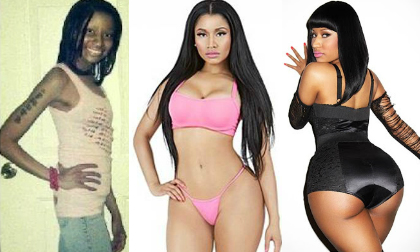 Sự khác biệt khó tin của Nicki Minaj trước khi 'độn' nhựa toàn thân 