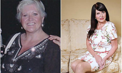 Bà vợ chi gần 1 tỷ đồng để trẻ hơn 20 tuổi